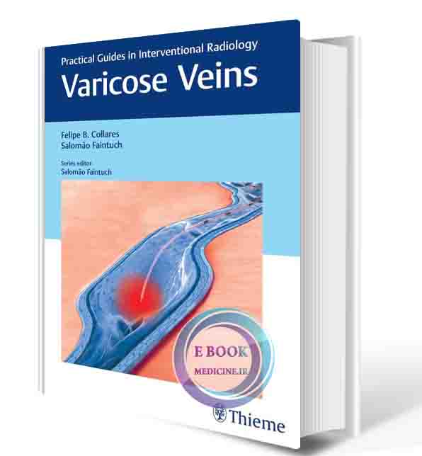 دانلود کتاب Varicose Veins: Practical Guides in Interventional Radiology 1st 2017 (ORIGINAL PDF)